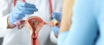 Gynecology